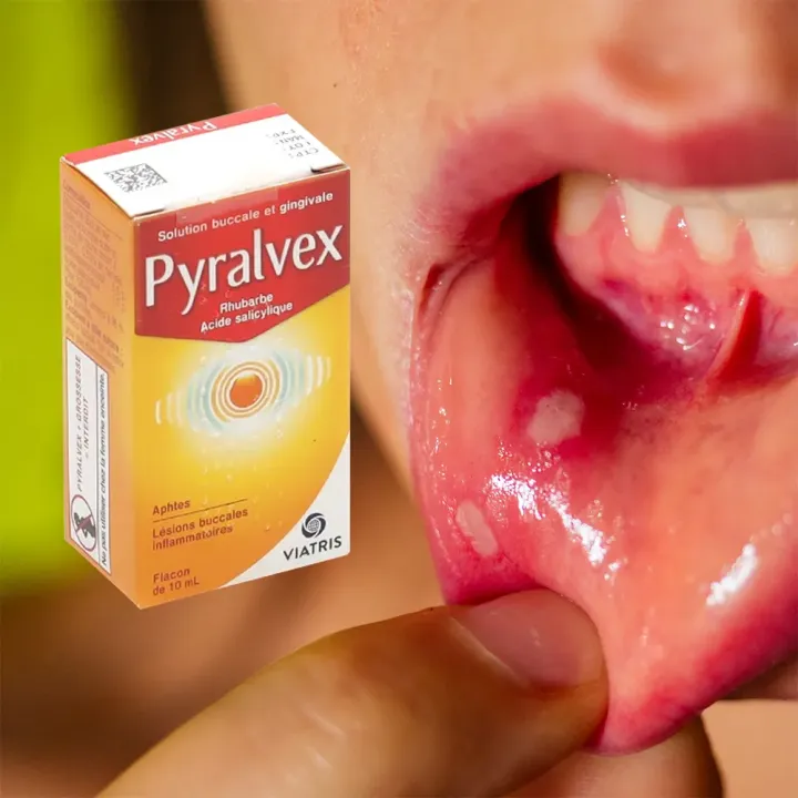 Pyralvex aphtes solution buccale/gingivale 10 ml | Pharmacie en ligne