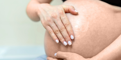 Vergetures durant la grossesse