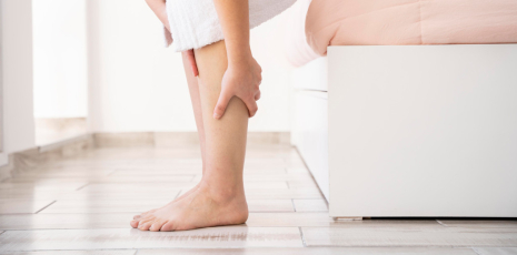 Varices, hémorroïdes et jambes lourdes : les traitements homéopathiques